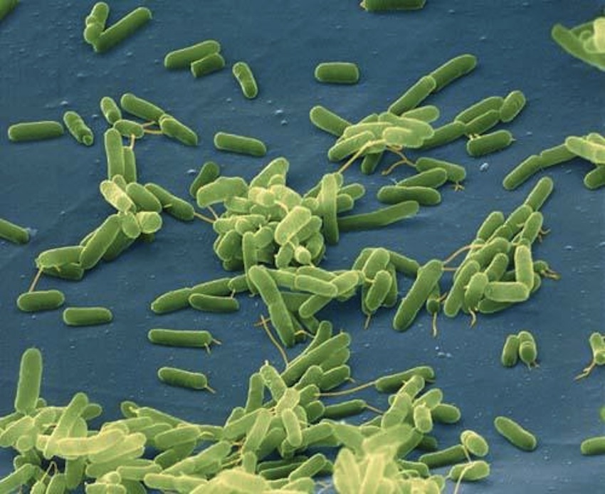 Vibrio vulnificus